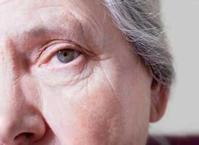 陽(yáng)春三月白內(nèi)障好時(shí)節(jié)，了解相關(guān)癥狀，別被忽悠了